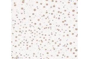 Immunohistochemistry analysis of paraffin-embedded mouse liver using,PQBP1 (ABIN7075126) at dilution of 1: 6000 (PQBP1 Antikörper)
