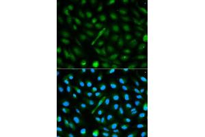 Immunofluorescence analysis of MCF-7 cells using AHSG antibody. (Fetuin A Antikörper  (AA 19-300))