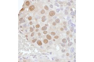 Immunohistochemistry (IHC) image for anti-Phosphate Cytidylyltransferase 1, Choline, alpha (PCYT1A) (AA 317-367) antibody (ABIN7453442) (PCYT1A Antikörper  (AA 317-367))