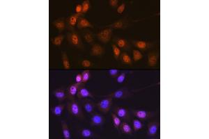 Immunofluorescence analysis of NIH-3T3 cells using Musashi-1 (MSI1) Rabbit mAb (ABIN7268700) at dilution of 1:100 (40x lens). (MSI1 Antikörper)