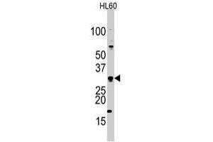 Western blot analysis of CDCA8 polyclonal antibody  in HL-60 cell line lysates (35 ug/lane). (CDCA8 Antikörper  (Internal Region))