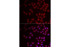 Immunofluorescence analysis of HeLa cell using CIRBP antibody. (CIRBP Antikörper)
