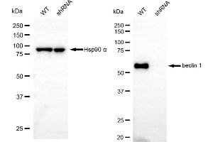 Western blotting analysis using beclin 1 antibody (ABIN7797761).
