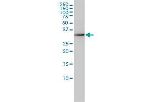 AKR7A2 monoclonal antibody (M01), clone 2A6 Western Blot analysis of AKR7A2 expression in HL-60 .