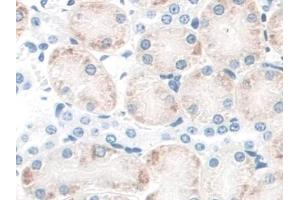 DAB staining on IHC-P; Samples: Mouse Kidney Tissue (CD164 Antikörper  (AA 24-162))