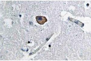 Immunohistochemistry analysis of CD171 / L1CAM Antibody in paraffin-embedded human brain tissue. (L1CAM Antikörper)