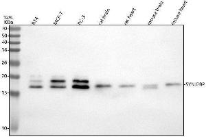 Western blot analysis of SYNJ2BP using anti-SYNJ2BP antibody (ABIN7601295).