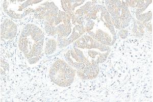 Immunohistochemistry (IHC) image for anti-Carbamoyl-Phosphate Synthetase 2, Aspartate Transcarbamylase, and Dihydroorotase (CAD) (AA 1850-2000) antibody (ABIN7454743)