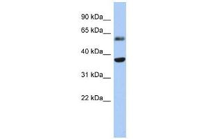 RDH10 antibody used at 1 ug/ml to detect target protein. (RDH10 Antikörper)