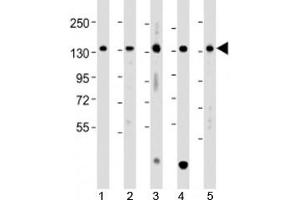 Western blot testing of human 1) A431, 2) HCT116, 3) Jurkat, 4) K562 and 5) U-2OS cell lysate with TACC3 antibody at 1:2000. (TACC3 Antikörper  (AA 317-350))