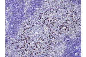 Immunohistochemistry (IHC) image for Rabbit anti-Human IgG (AA 167-185), (Internal Region) antibody (ABIN7598781) (Kaninchen anti-Human IgG (AA 167-185), (Internal Region) Antikörper)