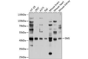 Western blot analysis of extracts of various cell lines, using SMS antibody (ABIN6133461, ABIN6148152, ABIN6148153 and ABIN6224911) at 1:1000 dilution. (SMS Antikörper  (AA 1-366))