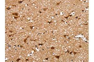 The image on the left is immunohistochemistry of paraffin-embedded Human brain tissue using ABIN7131195(SSBP4 Antibody) at dilution 1/25, on the right is treated with fusion protein. (SSBP4 Antikörper)