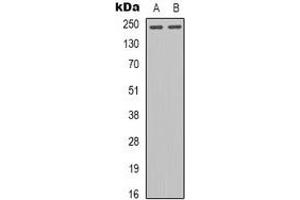 Western blot analysis of Tenascin C expression in U87MG (A), KB (B) whole cell lysates. (TNC Antikörper  (C-Term))