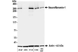 Western Blotting (WB) image for anti-Neurofibromin 1 (NF1) (C-Term) antibody (ABIN7795775) (Rekombinanter Neurofibromin 1 Antikörper  (C-Term))
