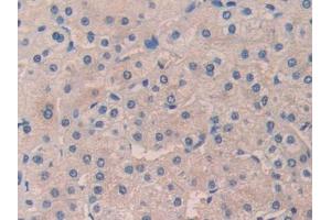 Used in DAB staining on fromalin fixed paraffin-embedded Kidney tissue (desert Hedgehog Antikörper  (AA 241-383))