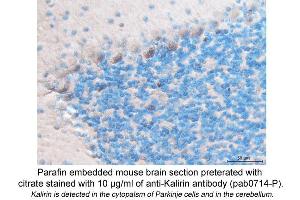 Image no. 1 for anti-Kalirin, RhoGEF Kinase (KALRN) (C-Term) antibody (ABIN559714) (KALRN Antikörper  (C-Term))
