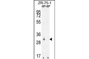 Western blot analysis of RAB40AL Antibdy (N-term) Pab (ABIN655950 and ABIN2845336) pre-incubated without(lane 1) and with(lane 2) blocking peptide in ZR-75-1 cell line lysate. (RAB40AL Antikörper  (N-Term))