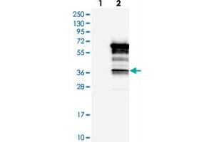 Western blot analysis of Lane 1: Negative control (vector only transfected HEK293T lysate), Lane 2: Over-expression Lysate (Co-expressed with a C-terminal myc-DDK tag (~3. (SASH3 Antikörper)
