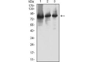 Western Blotting (WB) image for anti-Ribonucleotide Reductase M1 (RRM1) (AA 541-792) antibody (ABIN7193575)