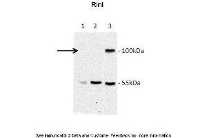 Lanes:  Lane 1: Jurkat lysate Lane 2: HeLa lysate Lane 3: GFP-Rinl transfected COS7 lysate Primary Antibody Dilution:  1:1000 Secondary Antibody:  Goat anti-rabbit-HRP Secondary Antibody Dilution:  1:5000 Gene Name:  RINL Submitted by:  Barbara Woller; Medical University of Vienna (RINL Antikörper  (N-Term))