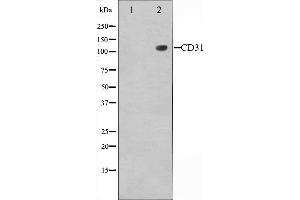 Western blot analysis of PECAM-1 expression in Jurkat whole cell lysates,The lane on the left is treated with the antigen-specific peptide. (CD31 Antikörper  (C-Term))