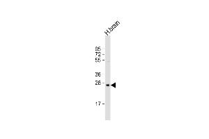 Anti-PRSS33 Antibody (Center) at 1:2000 dilution + human brain lysate Lysates/proteins at 20 μg per lane. (PRSS33 Antikörper  (AA 105-128))