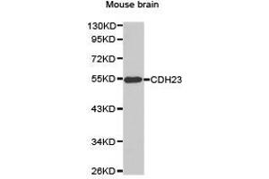 Western Blotting (WB) image for anti-Cadherin 23 (CDH23) antibody (ABIN1871707) (CDH23 Antikörper)