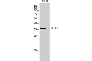 Western Blot analysis of 22RV1 cells using AR-β3 Polyclonal Antibody diluted at 1:1000. (ADRB3 Antikörper  (AA 220-300))
