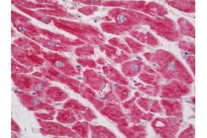 Human Heart: Formalin-Fixed, Paraffin-Embedded (FFPE). (NDUFB7 Antikörper  (FITC))