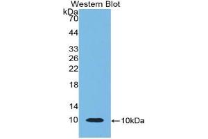 Western blot analysis of the recombinant protein. (beta-Thromboglobulin Antikörper  (AA 46-107))