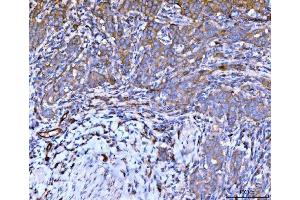 IHC analysis of Filamin B/FLNB using anti-Filamin B/FLNB antibody (ABIN7601606).