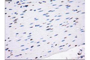 Immunohistochemical staining of paraffin-embedded colon tissue using anti-RC213323 mouse monoclonal antibody. (LOX Antikörper  (AA 22-168))