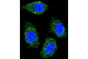 Confocal immunofluorescent analysis of TNFSF15 Antibody (Center) with Hela cell followed by Alexa Fluor® 489-conjugated goat anti-rabbit lgG (green).