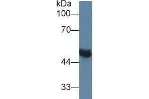 Western Blot; Sample: Rat Serum; Primary Ab: 1µg/ml Rabbit Anti-Rat MMP13 Antibody Second Ab: 0.