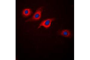 Immunofluorescent analysis of GLP-1 Receptor staining in SKNSH cells. (GLP1R Antikörper  (Center))