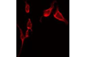 ABIN6275574 staining Hela by IF/ICC. (SLC6A1 Antikörper  (Internal Region))