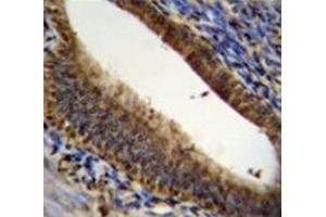 Immunohistochemistry analysis in human uterus tissue (Formalin-fixed, Paraffin-embedded) using Prothymosin alpha  Antibody (N-term), followed by peroxidase conjugated secondary antibody and DAB staining.