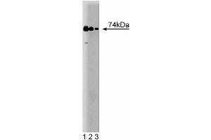 Western blot analysis of RIP on a human endothelial cell lysate. (RIPK1 Antikörper  (AA 385-650))