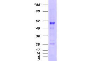 Validation with Western Blot