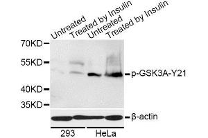 Western blot analysis of extracts of 293 and HeLa cells, using Phospho-GSK3A-S21 antibody (ABIN5995655) at 1/1000 dilution. (GSK3 alpha Antikörper  (pSer21))