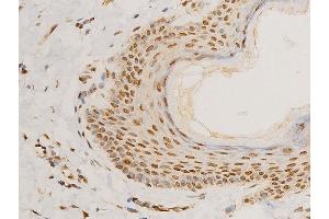 Immunohistochemistry (IHC) image for anti-Lamin A/C (LMNA) (pSer392) antibody (ABIN6256311)