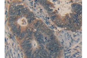 Immunohistochemistry (IHC) image for anti-Fas Ligand (TNF Superfamily, Member 6) (FASL) antibody (ABIN7439063)