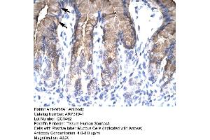 Rabbit Anti-NR4A1 Antibody  Paraffin Embedded Tissue: Human Stomach Cellular Data: Mucous Cells Antibody Concentration: 4. (NR4A1 Antikörper  (N-Term))
