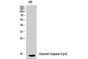 Western Blot analysis of KB cells using Cleaved-CASP3 p12 (D175) Polyclonal Antibody at dilution of 1:1000. (Caspase 3 p12 (Cleaved-Asp175) Antikörper)
