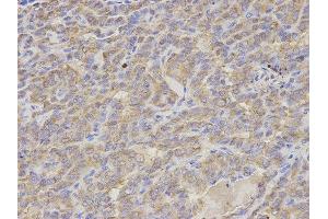 Immunohistochemistry (IHC) image for anti-S100 Calcium Binding Protein A12 (S100A12) antibody (ABIN1876516) (S100A12 Antikörper)