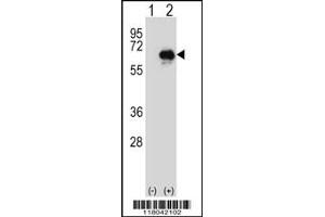 Western blot analysis of CETP using rabbit polyclonal CETP Antibody using 293 cell lysates (2 ug/lane) either nontransfected (Lane 1) or transiently transfected (Lane 2) with the CETP gene.