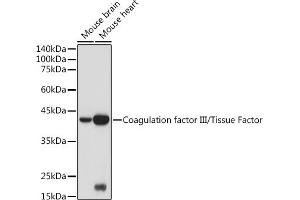 Western blot analysis of extracts of various cell lines, using Coagulation factor III/Tissue Factor antibody (ABIN3021933, ABIN3021934, ABIN3021935 and ABIN6217895) at 1:500 dilution. (Tissue factor Antikörper)