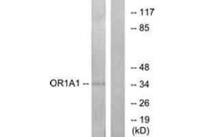 Western blot analysis of extracts from COLO cells, using OR1A1 Antibody. (OR1A1 Antikörper  (AA 260-309))