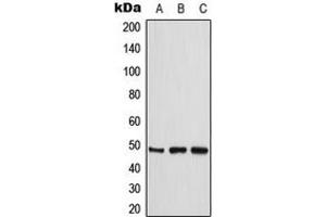 Western blot analysis of CKMT2 expression in THP1 (A), HeLa (B), Jurkat (C) whole cell lysates. (CKMT2 Antikörper  (Center))